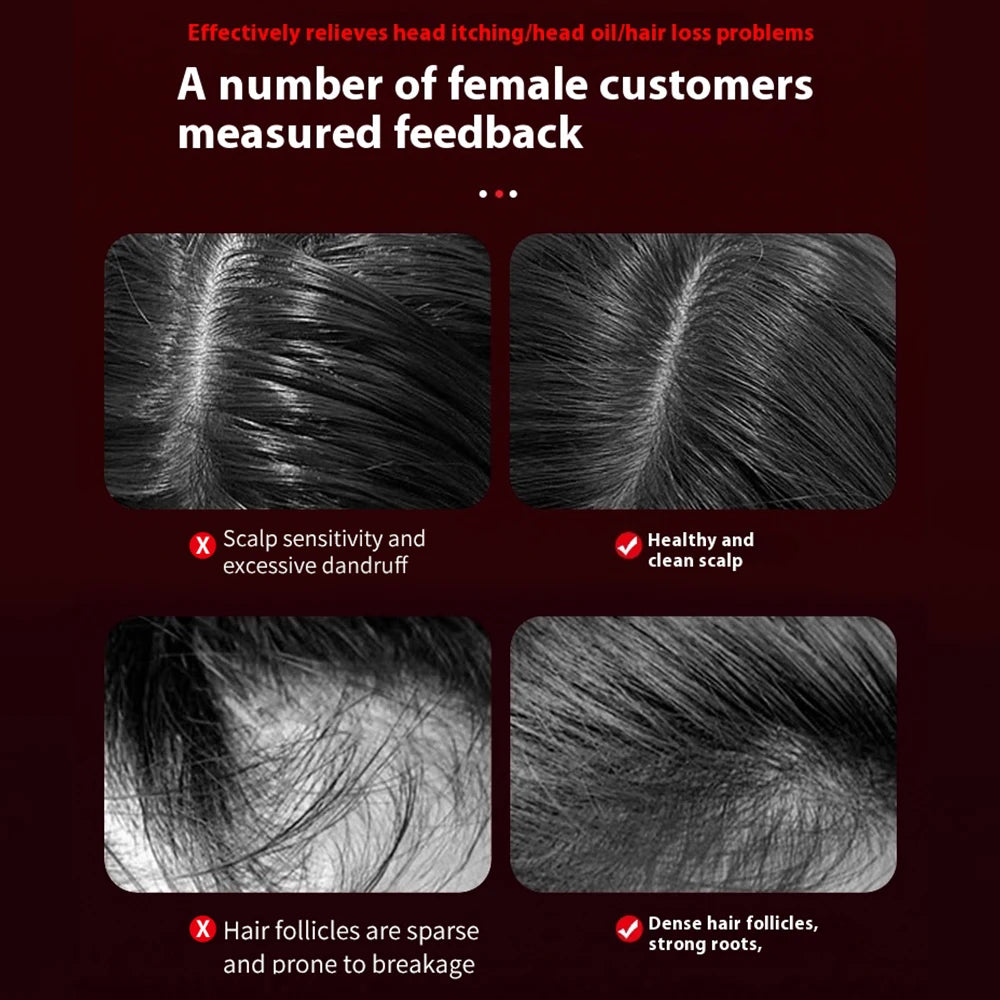 Red Light Scalp Massage Comb – Wake Up Your Hair Roots Now