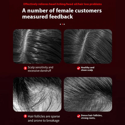 Red Light Scalp Massage Comb – Wake Up Your Hair Roots Now