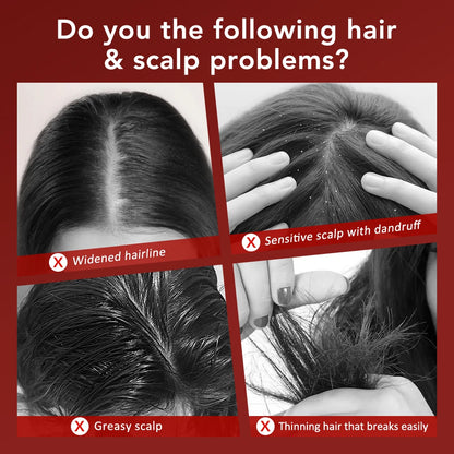 Red Light Scalp Massage Comb – Wake Up Your Hair Roots Now